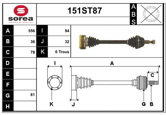 151ST87